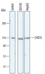 CHD1L Antibody in Western Blot (WB)