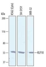 KLF10 Polyclonal Antibody
