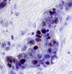 NCoR2 Antibody in Immunohistochemistry (Paraffin) (IHC (P))