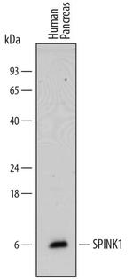 SPINK1 Polyclonal Antibody