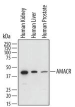 AMACR Antibody in Western Blot (WB)