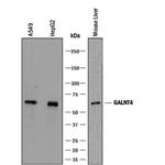 GALNT4 Polyclonal Antibody
