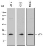 eIF5A Polyclonal Antibody