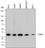 PSMA1 Polyclonal Antibody