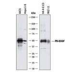 Thymidine Phosphorylase Polyclonal Antibody