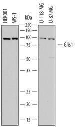 GLIS1 Polyclonal Antibody