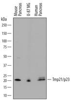 TMP21 Polyclonal Antibody