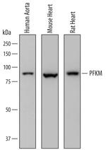 PFKM Polyclonal Antibody