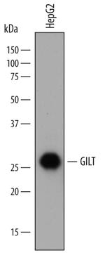 IFI30 Polyclonal Antibody