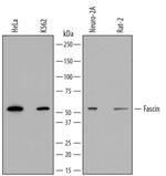 Fascin Polyclonal Antibody