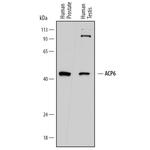 ACP6 Polyclonal Antibody