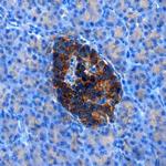 RFX6 Antibody in Immunohistochemistry (Paraffin) (IHC (P))