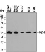 NQO2 Polyclonal Antibody