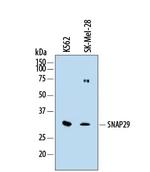 SNAP29 Polyclonal Antibody
