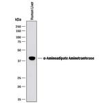 AADAT Polyclonal Antibody
