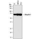 Ubiquilin 1 Polyclonal Antibody