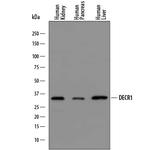 DECR1 Polyclonal Antibody