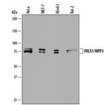 MPP5 Polyclonal Antibody