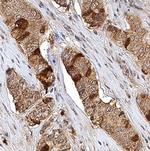 TK1 Polyclonal Antibody