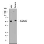 ASTL Polyclonal Antibody