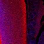 GDF6 Polyclonal Antibody