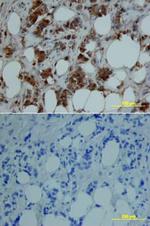 MMP8 Polyclonal Antibody