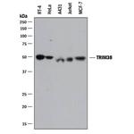 TRIM38 Polyclonal Antibody