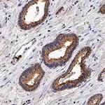 TBK1 Polyclonal Antibody