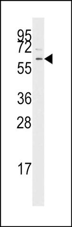 TGFBR1 Antibody in Western Blot (WB)