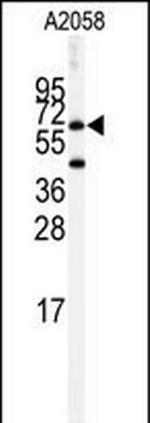 Butyrylcholinesterase Polyclonal Antibody