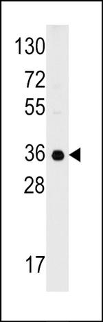 C1QBP Polyclonal Antibody
