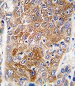 ALDH1L1 Polyclonal Antibody