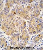 ALDH9A1 Polyclonal Antibody