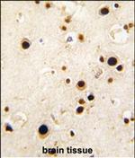 HnRNP Q Polyclonal Antibody