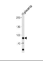 AMPD3 Polyclonal Antibody