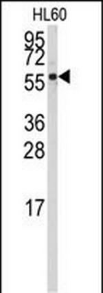 CYP4Z1 Polyclonal Antibody