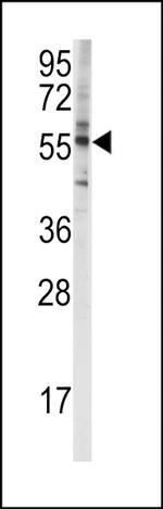 CYP4F8 Polyclonal Antibody