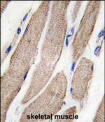 MEK5 Polyclonal Antibody
