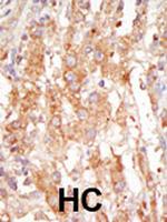 MEKK6 Polyclonal Antibody
