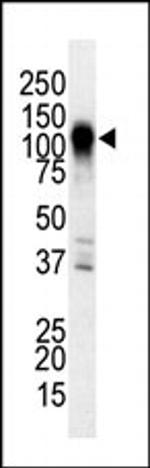 MEKK6 Antibody in Western Blot (WB)