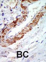 TPL2 Antibody in Immunohistochemistry (Paraffin) (IHC (P))