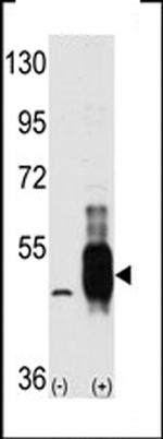 TPL2 Antibody in Western Blot (WB)