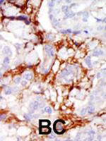 PAK3 Polyclonal Antibody