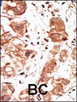 PIM1 Polyclonal Antibody