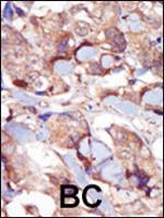 MLCK Polyclonal Antibody