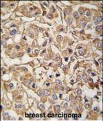 MLCK Antibody in Immunohistochemistry (Paraffin) (IHC (P))