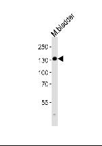 MYLK Polyclonal Antibody