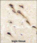 CYP26B1 Polyclonal Antibody