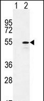 CYP26B1 Antibody in Western Blot (WB)