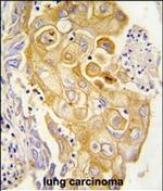 PTGIS Polyclonal Antibody